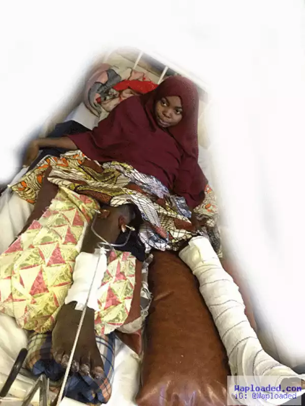 Zaria Shiite-Army Clash: See Photo Of Amina That Was Shot In Her Private Part